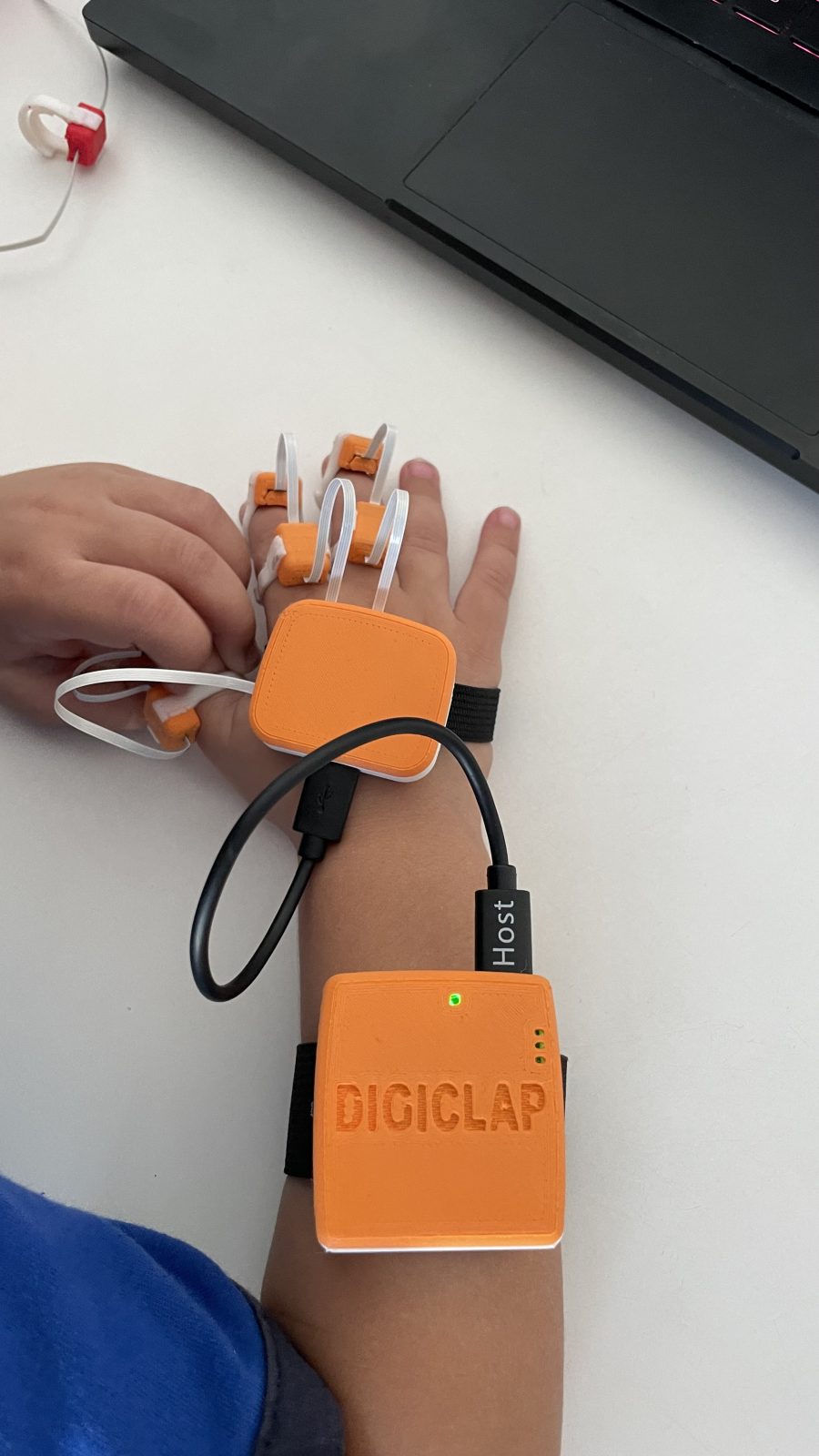 Smart wearables for children with cerebral palsy