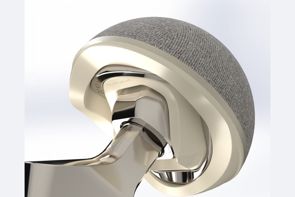 The ball of the hip joint
