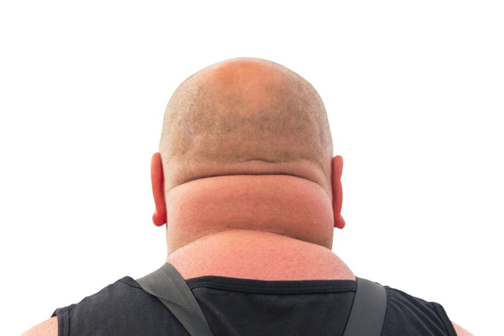 A photo of a wide neck from the back