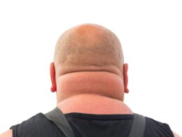 A photo of a wide neck from the back