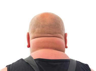 A photo of a wide neck from the back